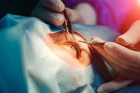 7 Essential Skills For Ophthalmic Surgical Techs