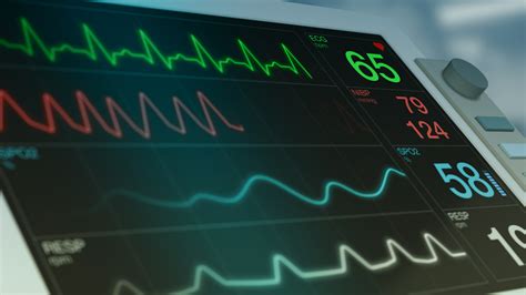 7 Ways Ekg Monitor Tech Improves Heart Health Monitoring