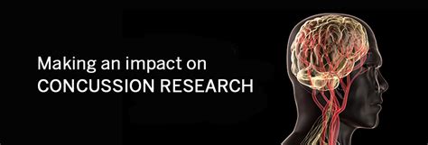 Concussion Research And Perspectives At Virginia Tech