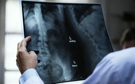 Radiology Tech School Costs: What To Expect